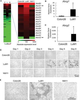 Depletion of Lipid Efflux Pump ABCG1 Triggers the Intracellular Accumulation of Extracellular Vesicles and Reduces Aggregation and Tumorigenesis of Metastatic Cancer Cells